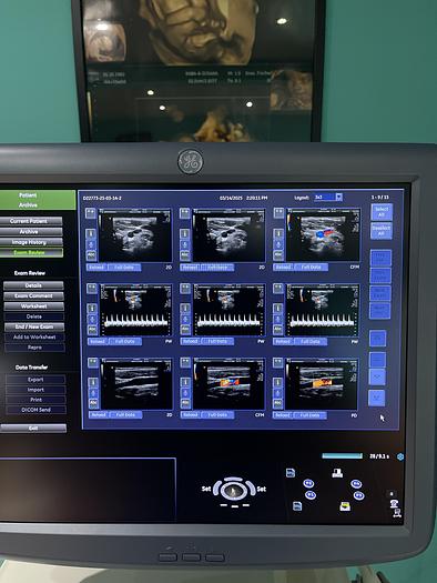 Gebraucht GE Voluson E8 BT13.5 Ultraschallgerät mit drei Sonden