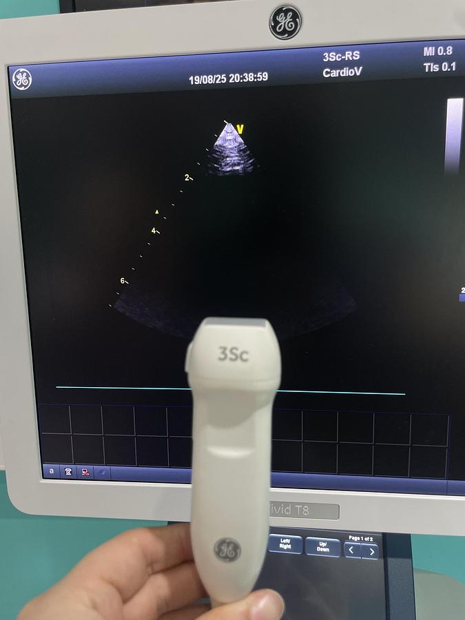 Gebraucht GE Vivid T8 Ultraschallgerät mit 3Sc-RS Kardiosonde