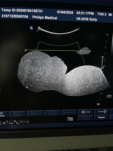 Gebraucht Philips iU22 Ultraschallgerät mit drei Ultraschallsonden