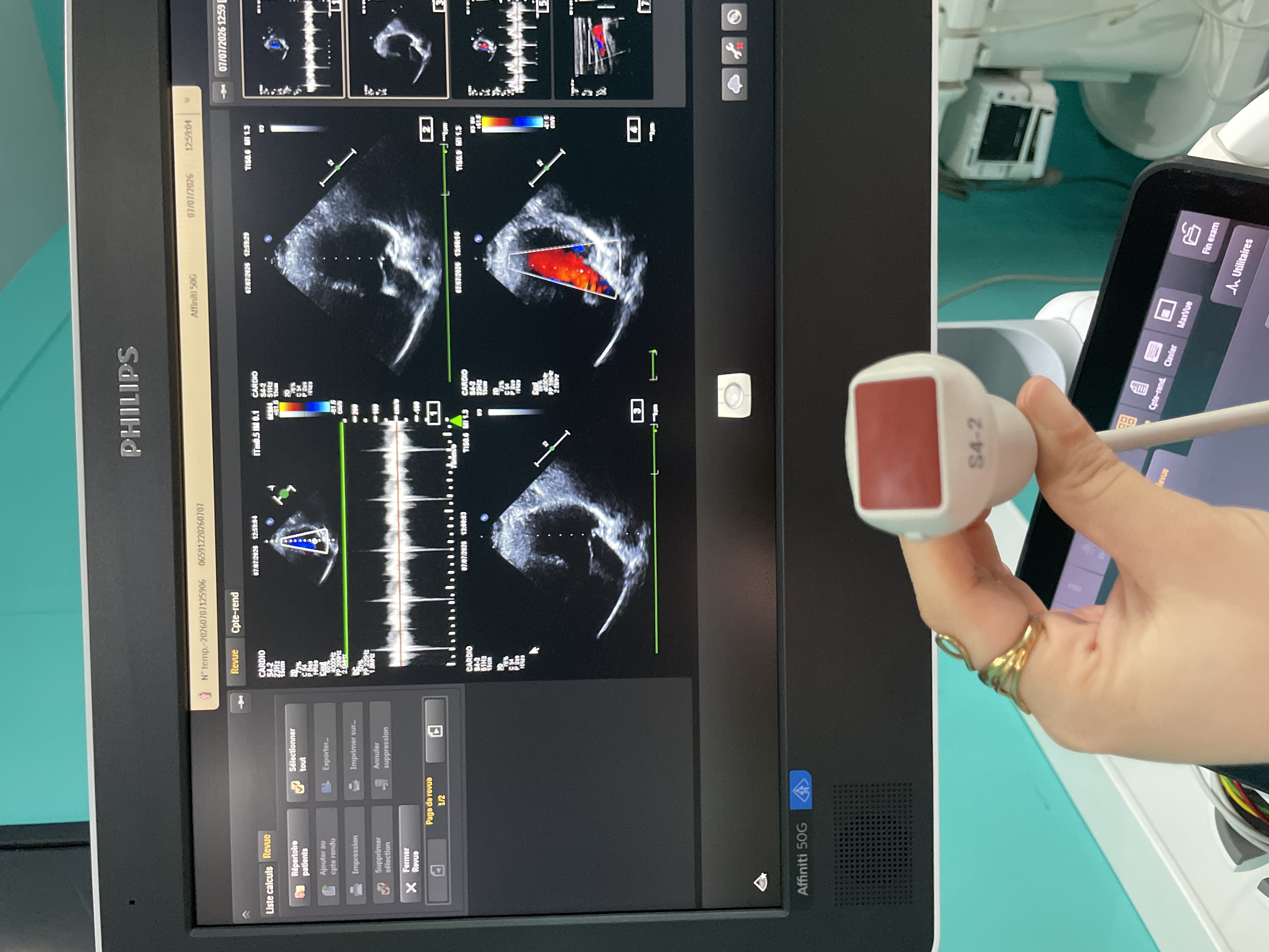 Gebraucht Philips S4-2 Kardio Ultraschallsonde