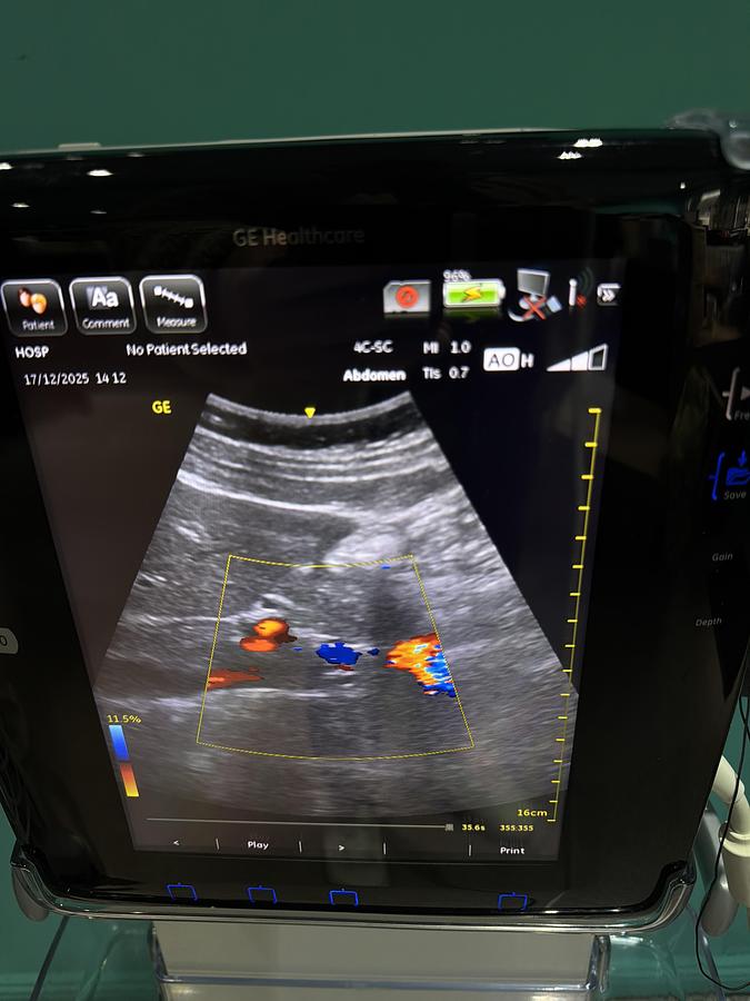 Gebraucht GE Venue 40 Ultraschallgerät mit Konvex Sonde