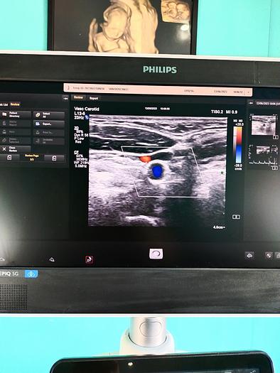 Gebraucht Philips Epiq 5G Flat Screen Ultrasound Scanner