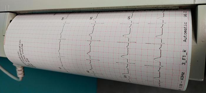 Gebraucht GE MAC 1200 ST EKG-Gerät