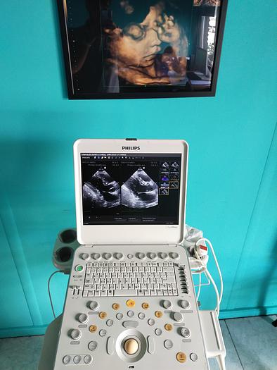 Gebraucht Philips CX50 Ultrasound with S5-1 and Trolly