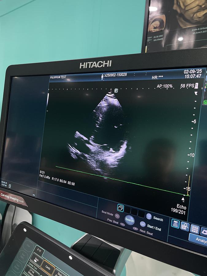 Gebraucht Hitachi ALOKA Arietta 850 Ultraschallgerät mit zwei Sonden und Drucker