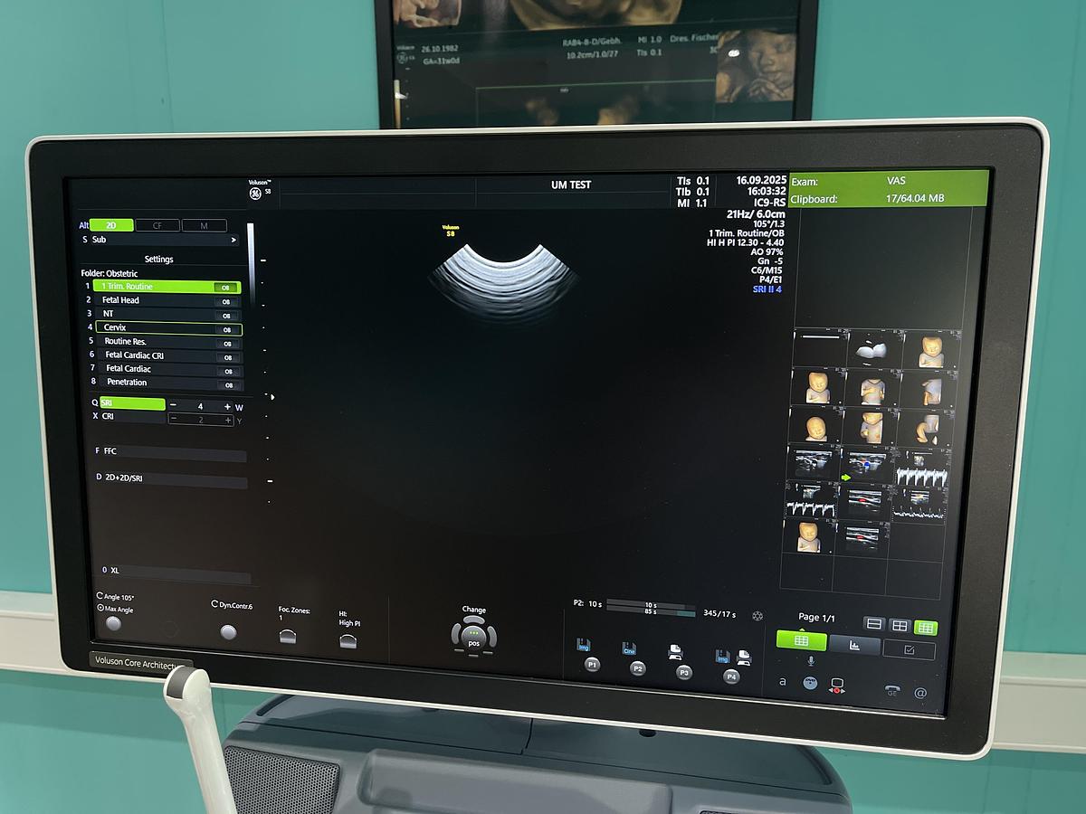 Gebraucht GE Voluson S8 Ultraschallgerät mit drei Sonden und Drucker