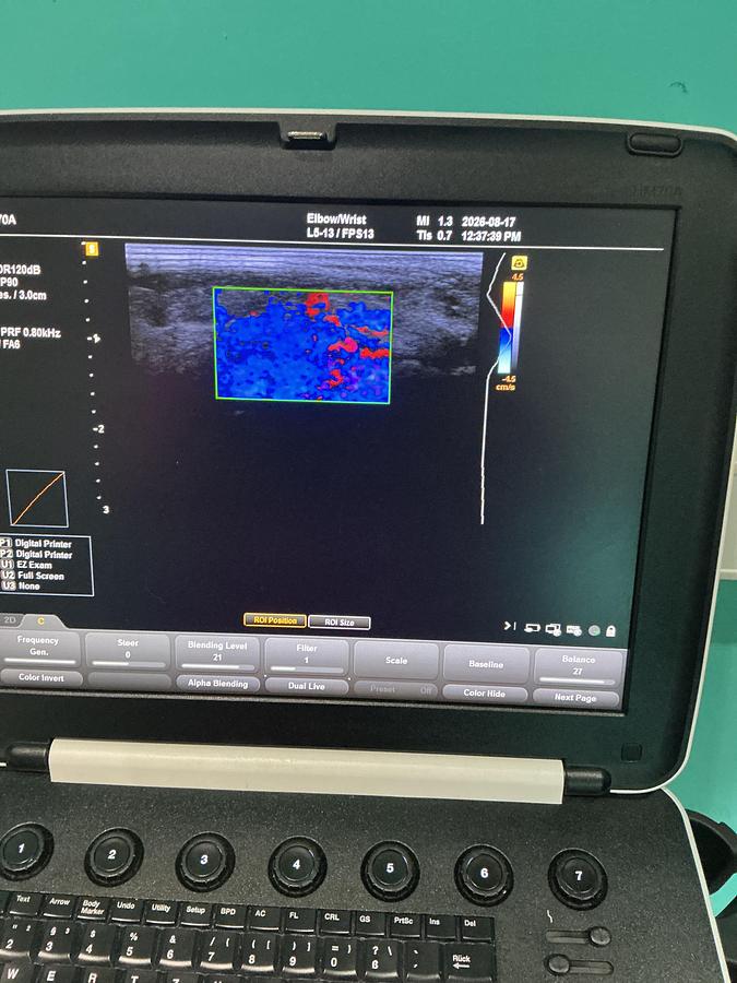 Gebraucht Samsung Medison HM7AF1B Ultraschallgerät mit zwei Sonden
