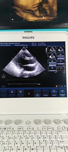 Gebraucht Philips CX50 Ultraschallgerät mit Sektor Sonde SW 2.5.1