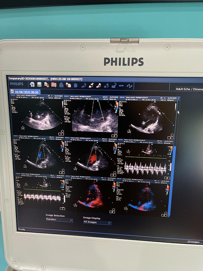 Gebraucht Philips CX50 Ultraschallgerät mit S5-1 Kardiosonde