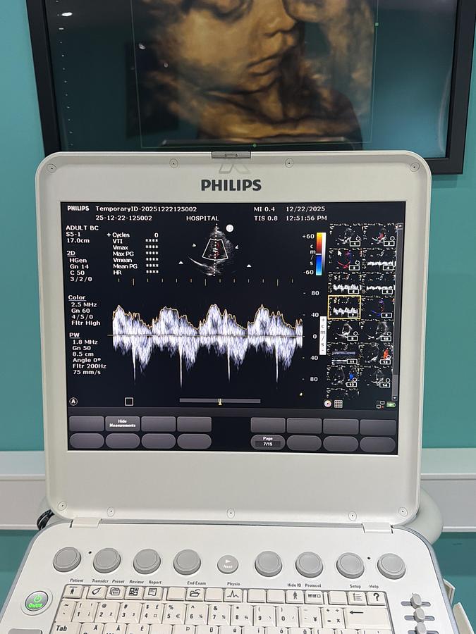 Gebraucht Philips CX50 SWUltraschallgerät mit S5-1 Kardiosonde