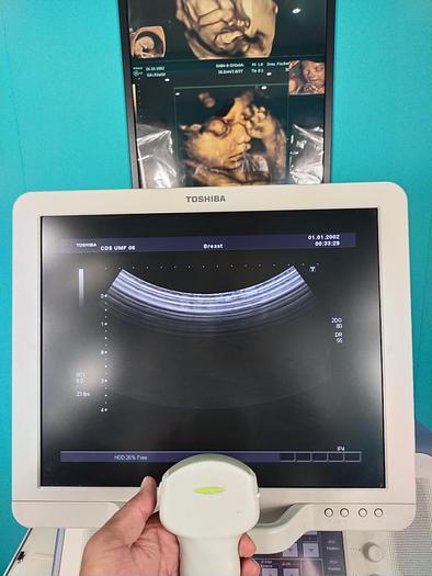 Gebraucht Toshiba Xario Ultraschal Gerät mit drei Sonde