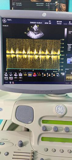 Gebraucht GE Vivid 7 Ultraschallgerät