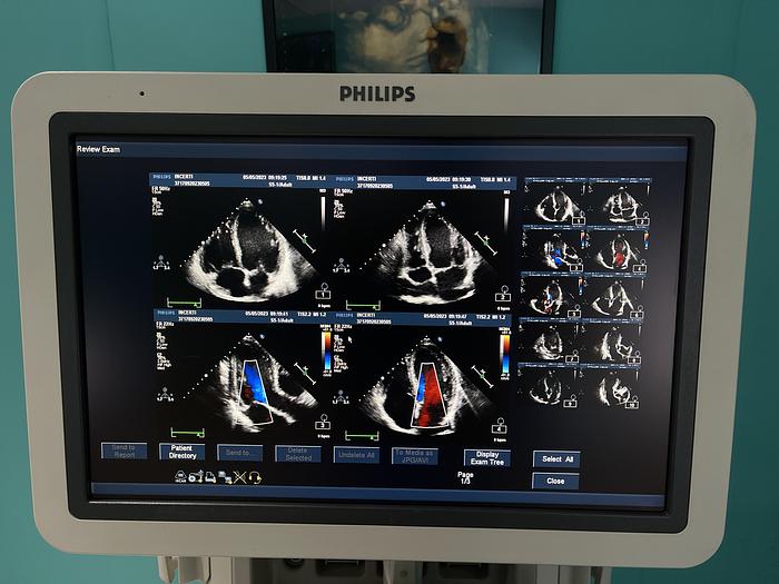 Gebraucht Philips iE33 Ultraschallgerät