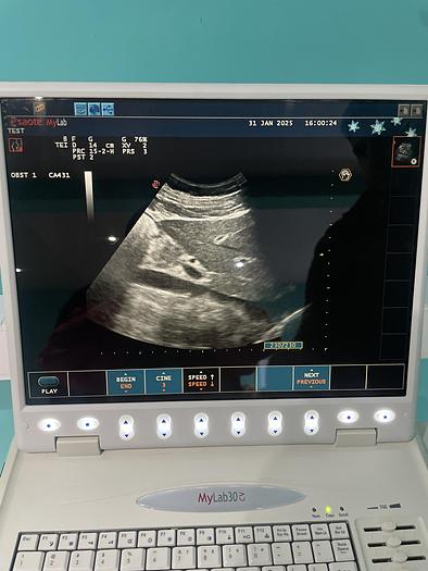 Gebraucht Esaote MyLab30CD Ultraschallgerät mit zwei Sonden