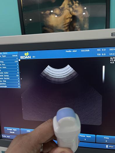 Used EDAN U2 Ultraschallgerät mit drei Sonden und Drucker