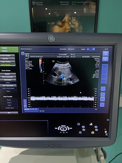 Gebraucht GE C1-5-D konvex Ultraschallsonde