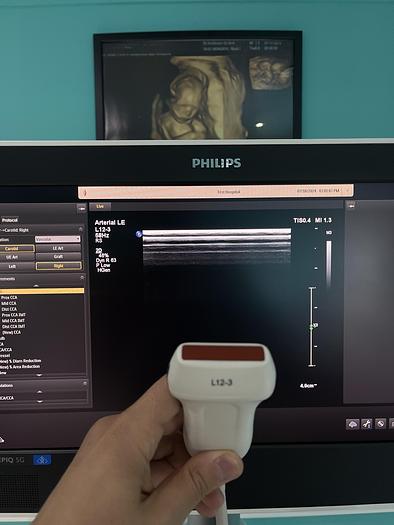 Used Philips EPIQ 5G Ultraschallgerät mit zwei Sonden