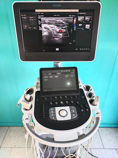 Gebraucht Philips  Affiniti 70G Screen Ultrasound Scanner 