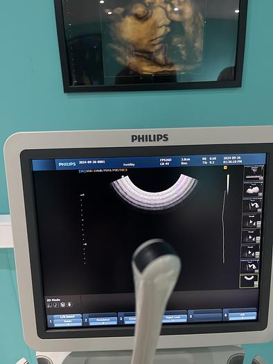 Used Philips HD9 Ultraschallgerät mit drei Sonden