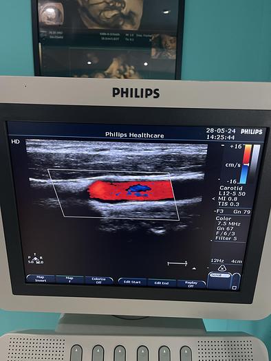 Gebraucht Philips L12-5 50 Linear Ultraschallsonde