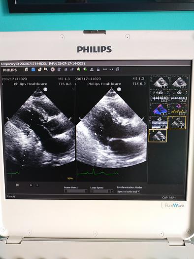 Gebraucht Philips CX50 Ultrasound with S5-1 and Trolly