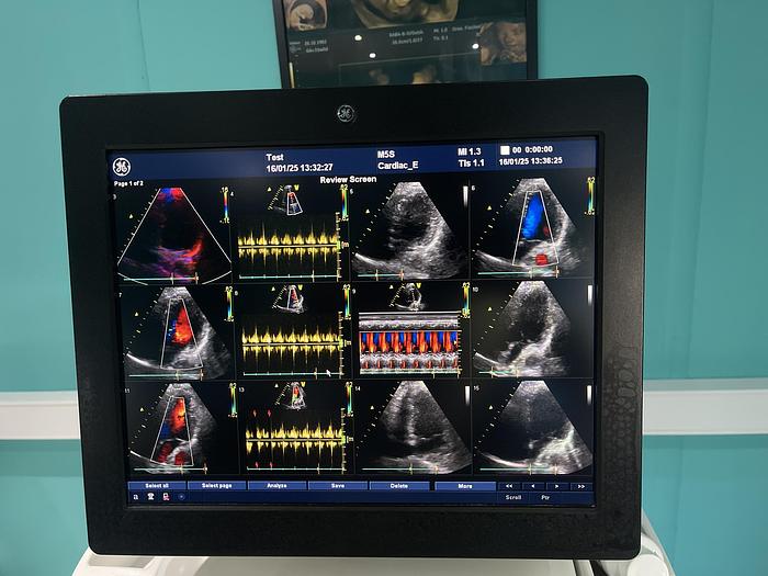 Gebraucht GE VIVID E9 Ultraschallgerät mit Kardiosonde
