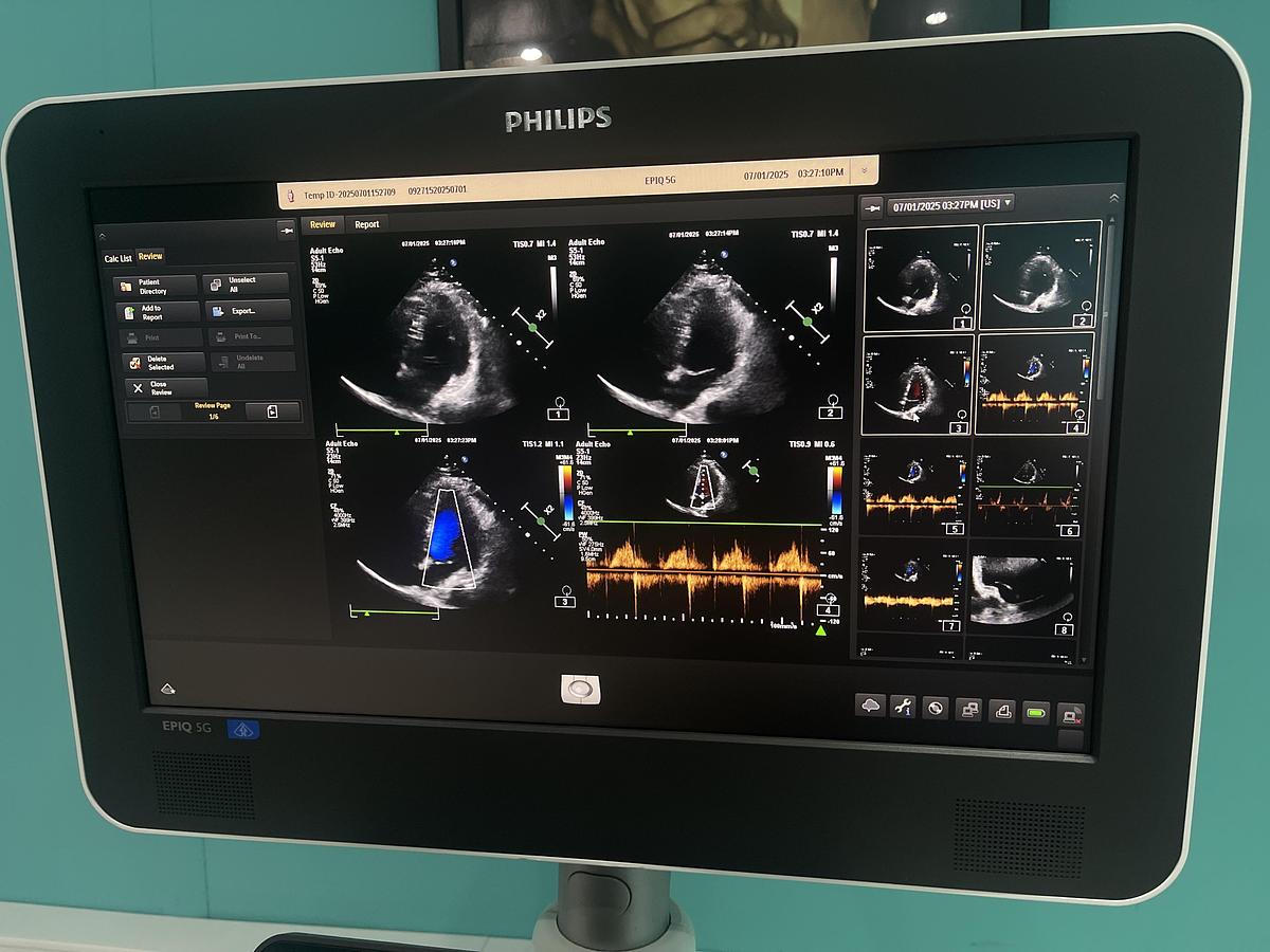 Gebraucht Philips EPIQ 5G Elite B Version Ultraschallgerät mit zwei Sonden