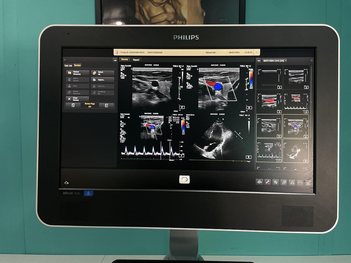 Gebraucht Philips Affiniti 50G Ultraschallgerät mit zwei Sonden