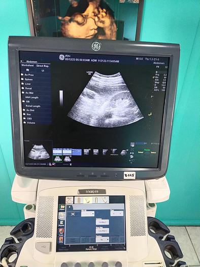 Gebraucht GE LOGIQ E9 Flachbildschirm-Ultraschallgerät