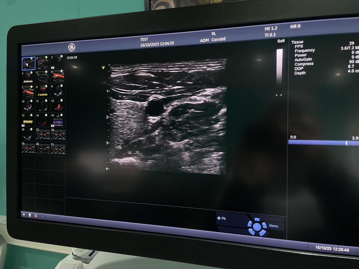 Gebraucht GE Vivid E95 v202 Ultraschallgerät mit zwei Sonden