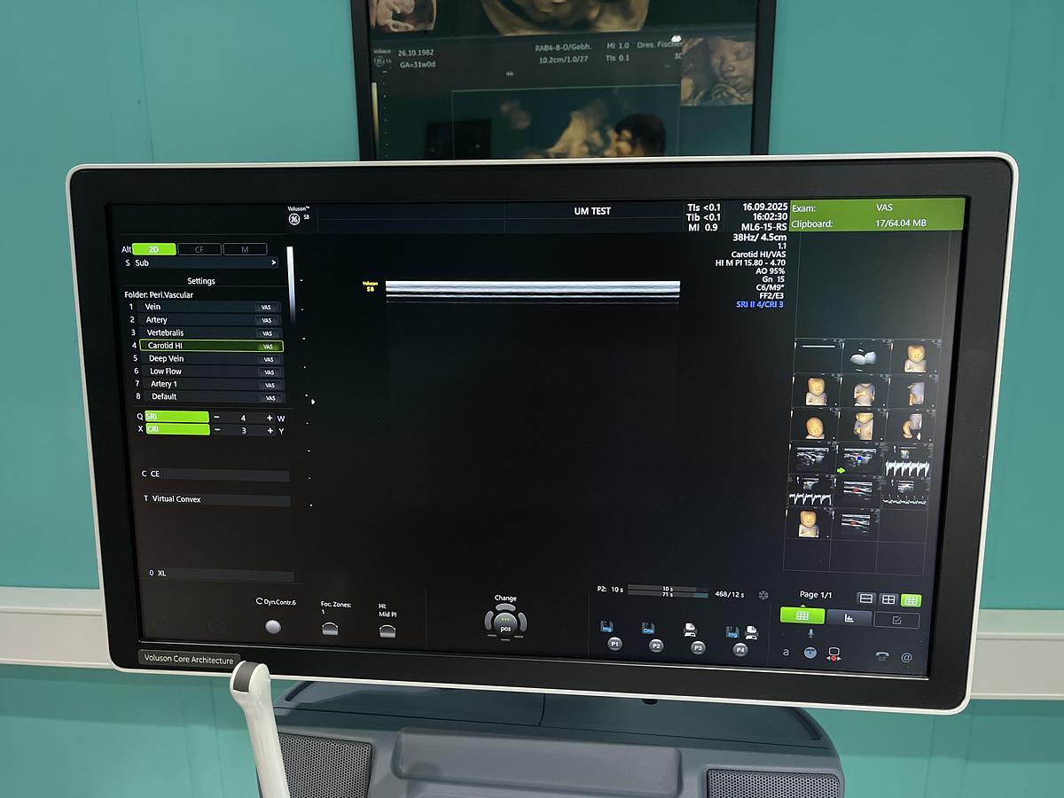 Gebraucht GE Voluson S8 Ultraschallgerät mit drei Sonden und Drucker