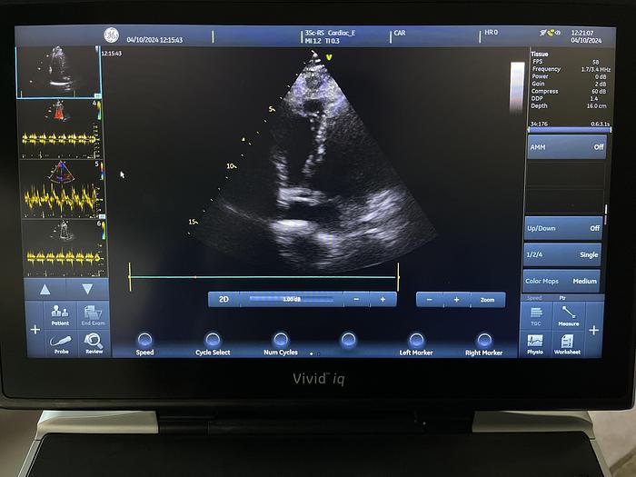 Used GE 3SC-RS Sektor Ultraschallsonde 