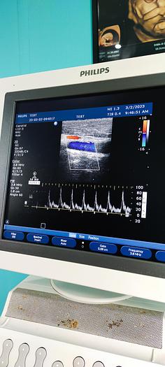 Gebraucht Philips HD11XE Ultraschallgerät mit 3 Sonde