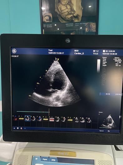 Gebraucht GE VIVID E9 Ultraschallgerät mit Kardiosonde