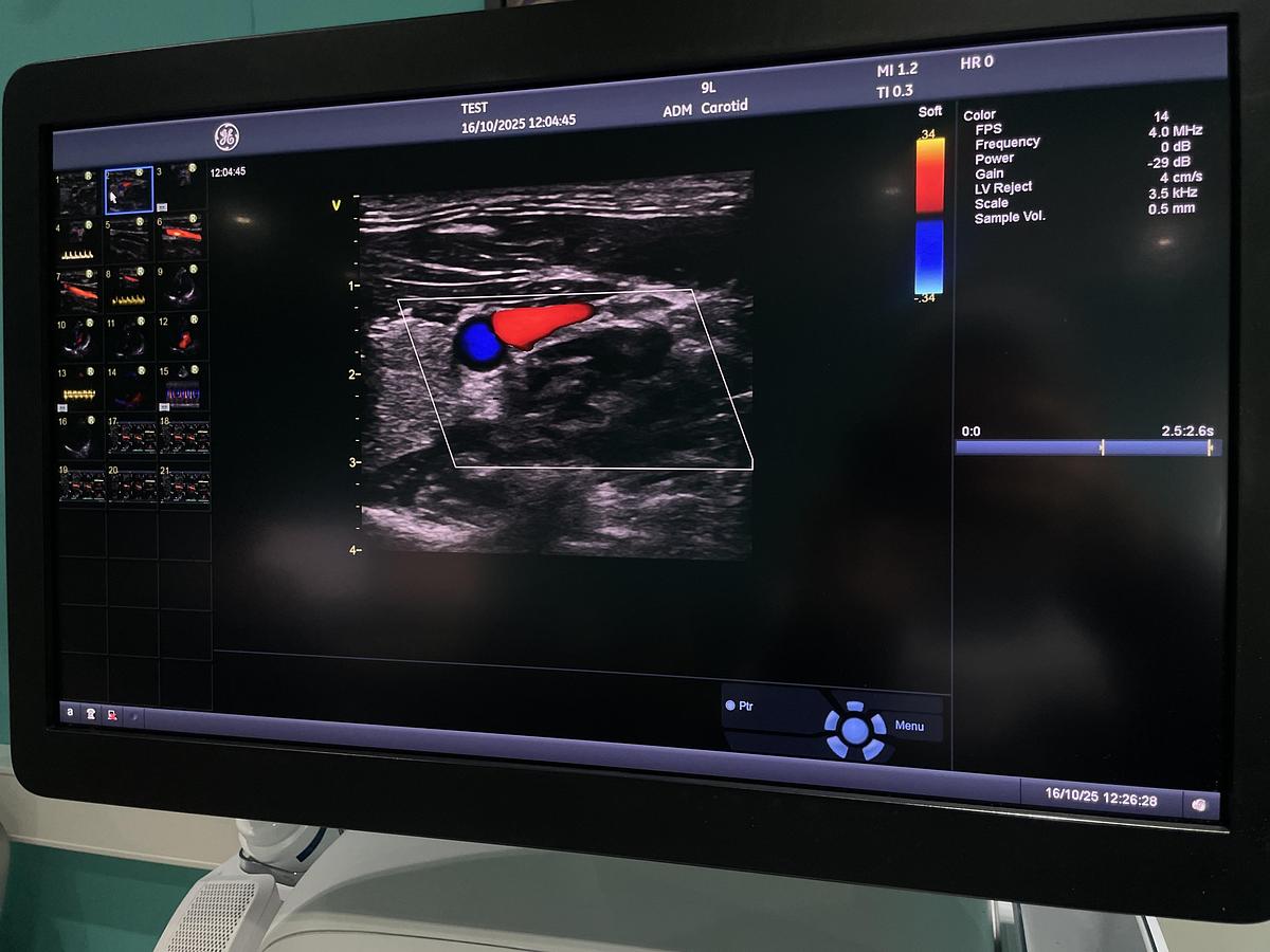 Gebraucht GE Vivid E95 v202 Ultraschallgerät mit zwei Sonden