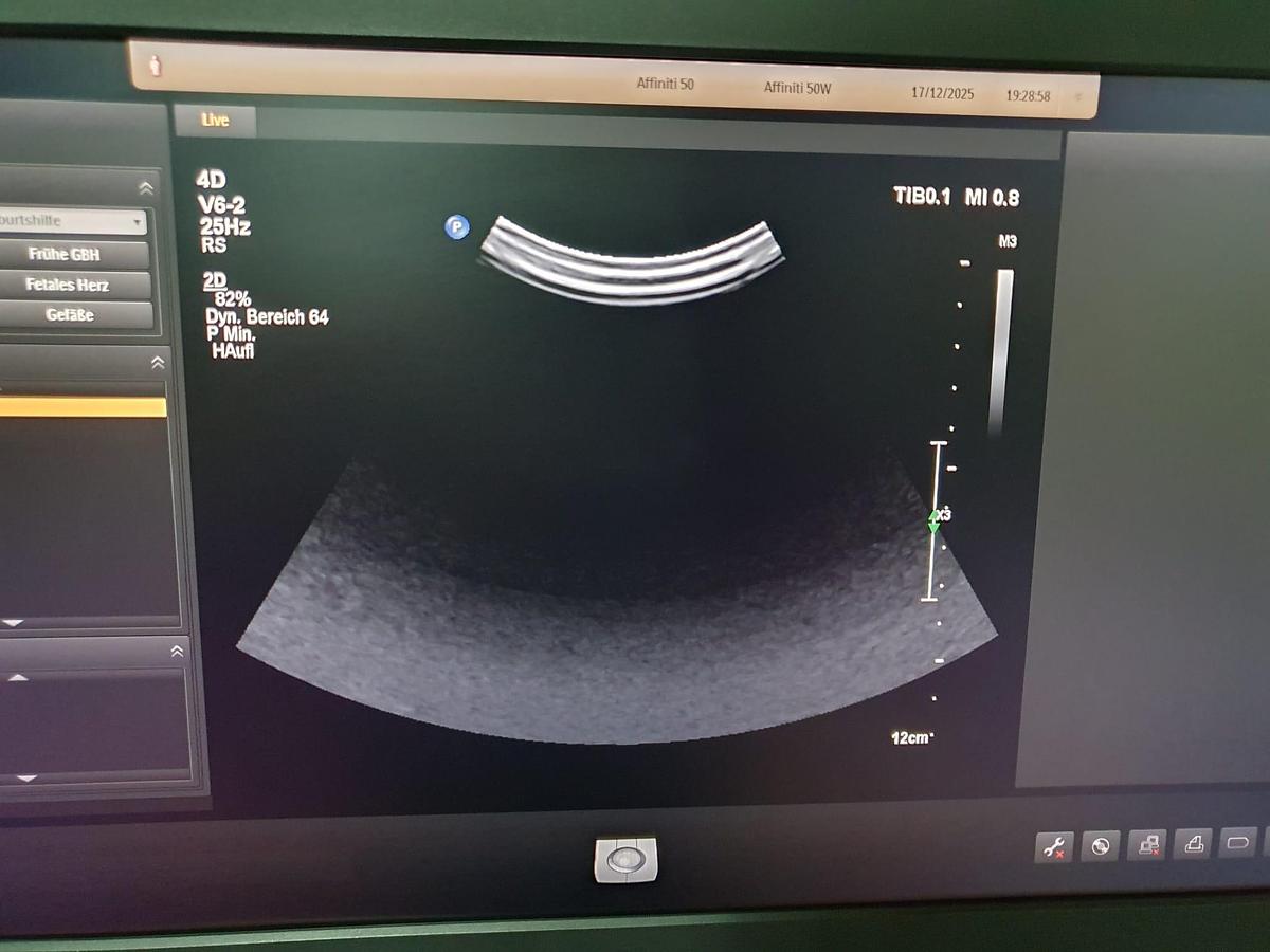 Gebraucht Philips V6-2 3D/4D Konvex Ultraschallsonde 