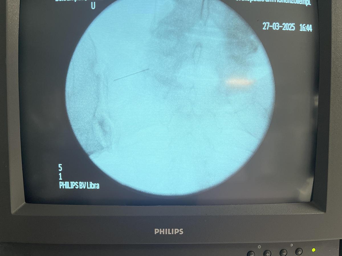 Used Philips BV Libra C-Bogen-System