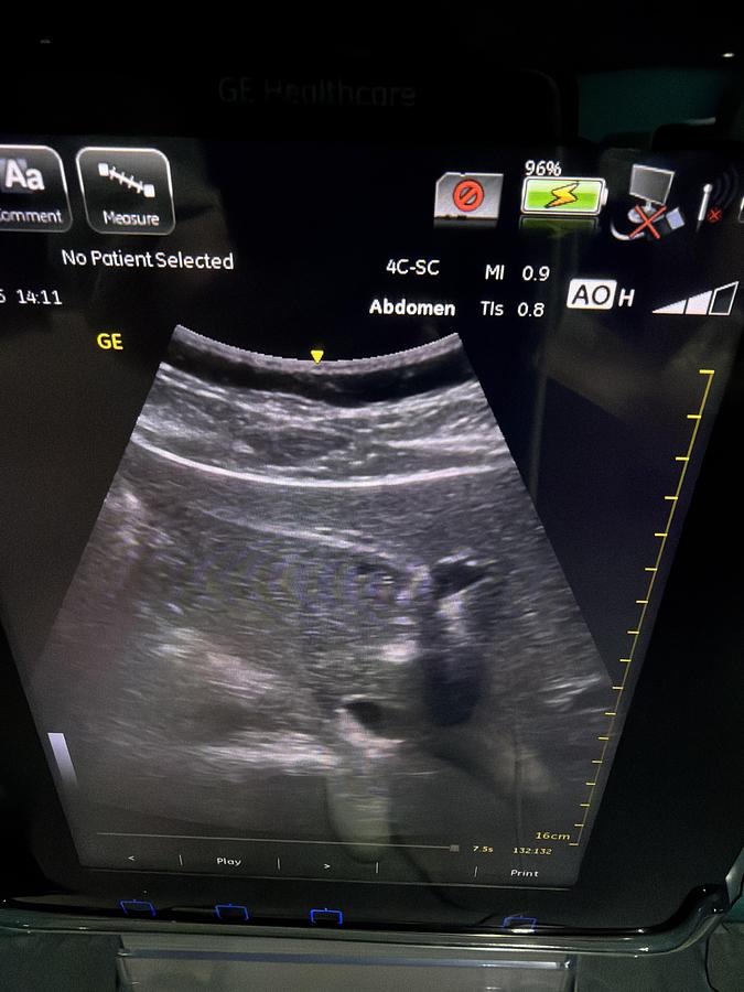 Gebraucht GE Venue 40 Ultraschallgerät mit Konvex Sonde