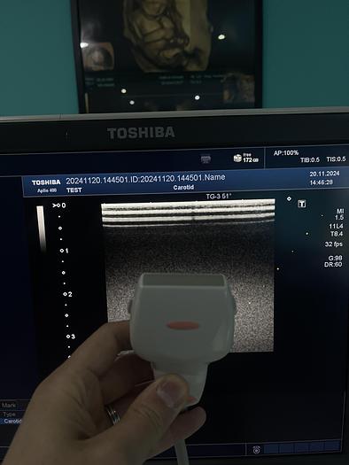 Used Toshiba Aplio 400 Ultraschallgerät mit 2 Sonden