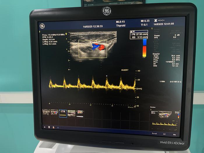 Gebraucht  GE ML6-15-D Ultraschallsonde