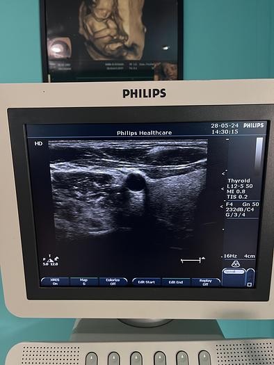 Gebraucht Philips L12-5 50 Linear Ultraschallsonde