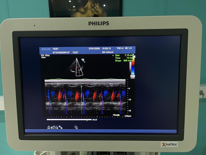 Used Philips iE33 HW G.1  xMatrix Ultraschallgerät mit S5-1 Kardiosonde und Drucker