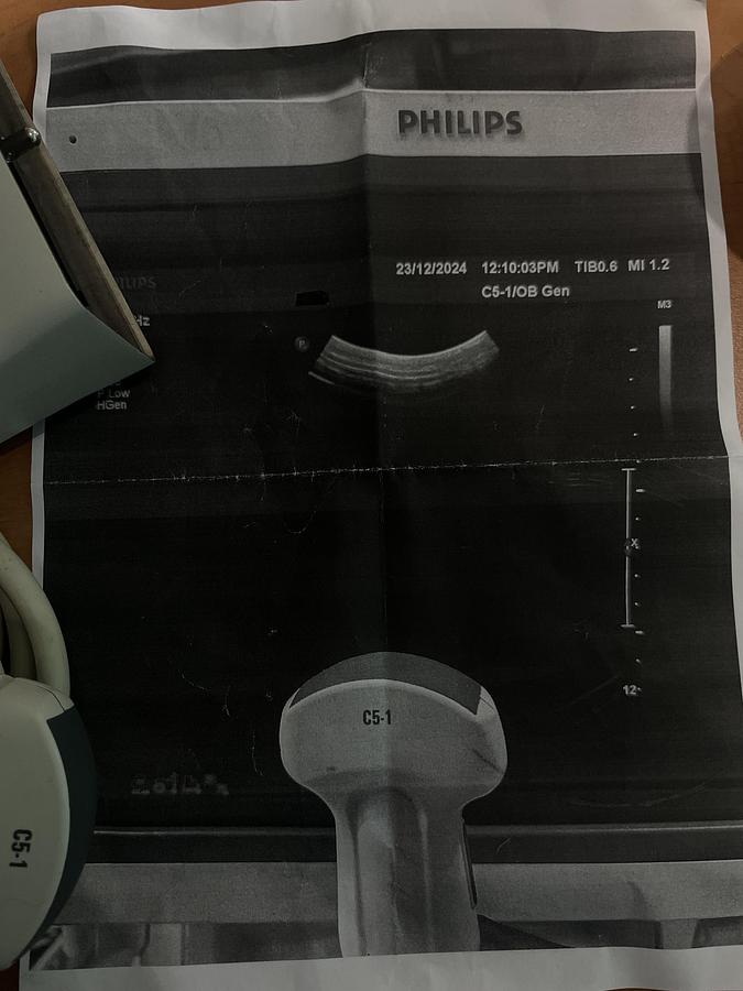 Gebraucht Philips C5-1 Konvex Ultraschallsonde