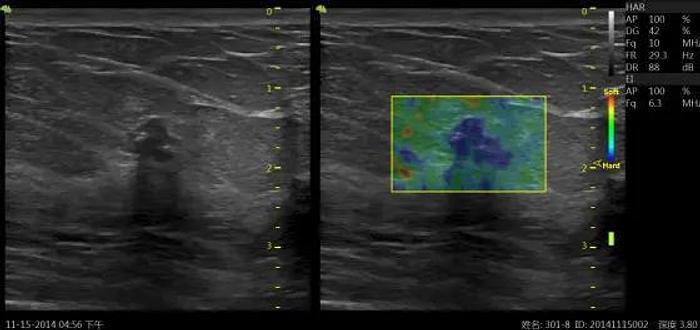 Gebraucht Vinno G55 Ultraschallgerät