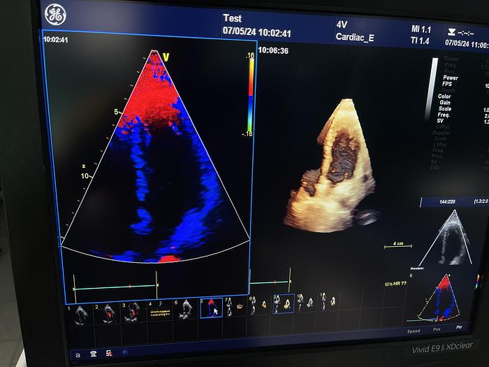 Gebraucht GE Vivid E9 XDClear Ultraschallgerät mit 2 Sonden
