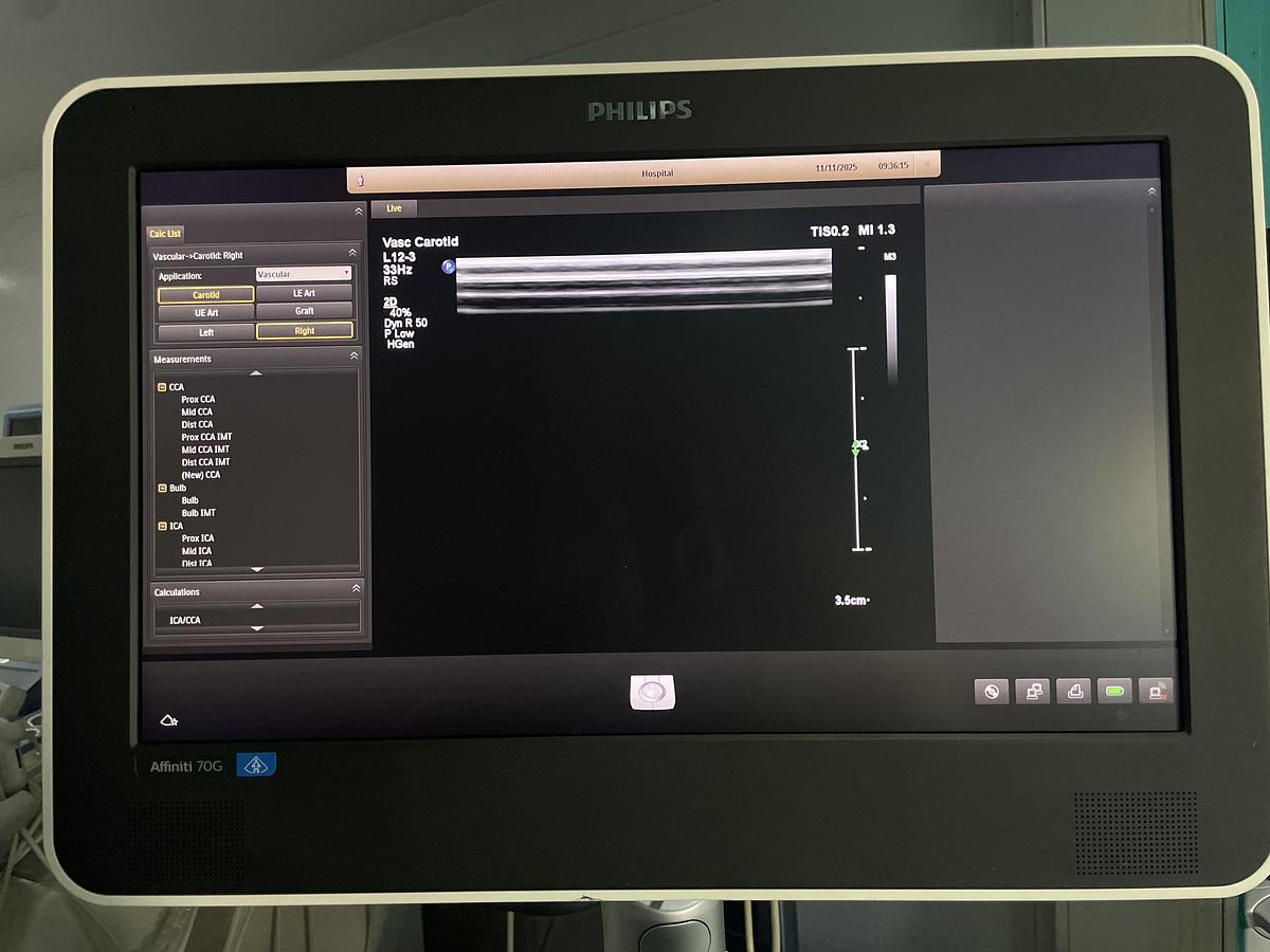 Gebraucht Philips L12-3 Linear Ultraschallsonde 