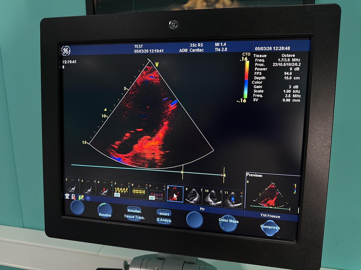 Gebraucht GE Vivid S6 Ultraschallgerät mit 3Sc-RS kardio Sonde