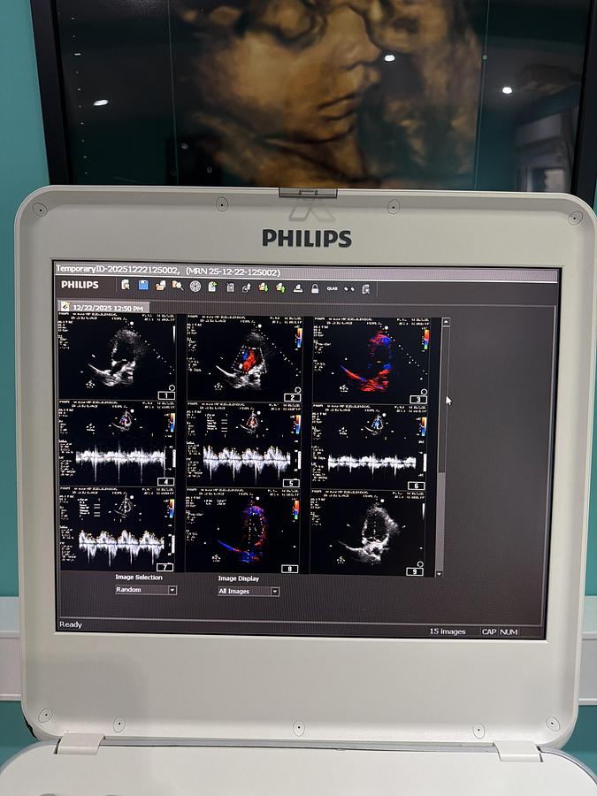 Gebraucht Philips CX50 Ultraschallgerät mit S5-1 Kardiosonde