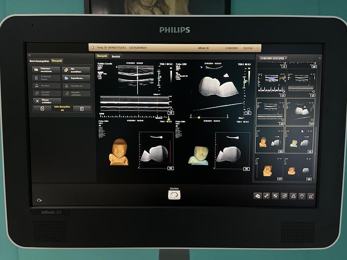 Used Philips Affiniti 30 Ultraschallgerät mit 3 Sonden und Drucker