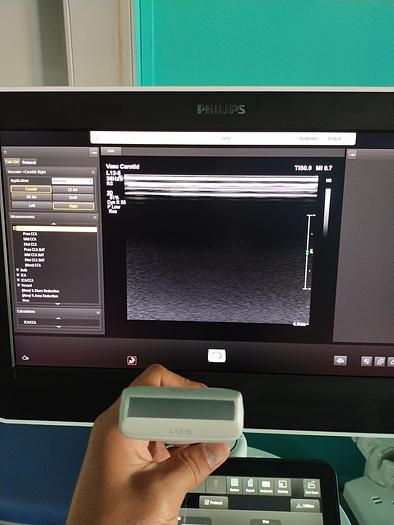 Gebraucht Philips L12-5 Ultraschallsonde